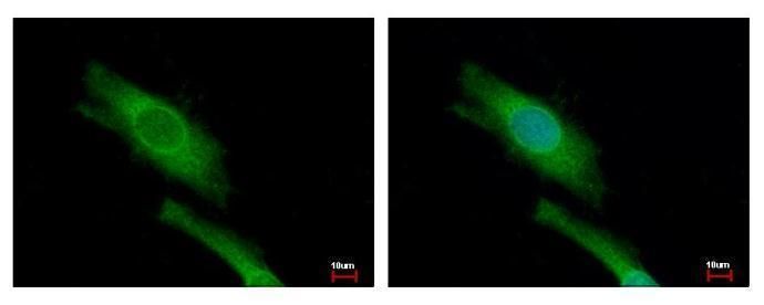 eukaryotic translation initiation factor 4 gamma 2 Antibody