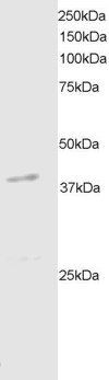 Goat anti-DAPK2 Antibody