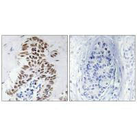 DAPK3 (Ab-265) Antibody