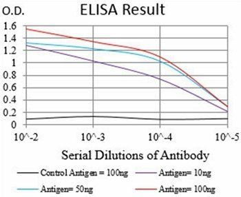 DAPK3 Antibody