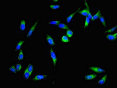 DAPK3 Antibody