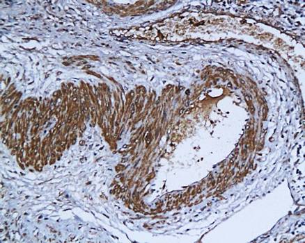 ZIP Kinase Rabbit Polyclonal Antibody