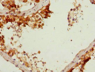 DAZ2 Antibody