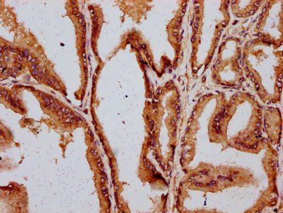 DAZAP2 Antibody