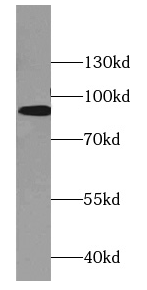 DBC1 antibody