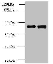 DBF4B antibody