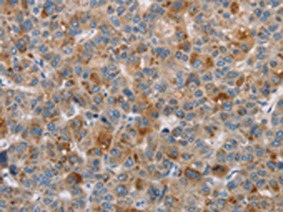 DBH Antibody