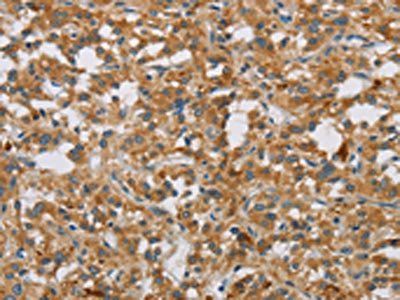 DBH Antibody