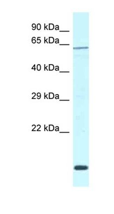 Dcaf11 antibody