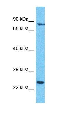 DCAF16 antibody