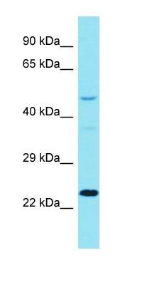 DCAF17 antibody