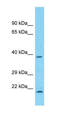 DCAF4 antibody