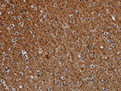 DCAF6 Antibody