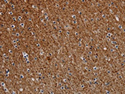 DCAF6 antibody