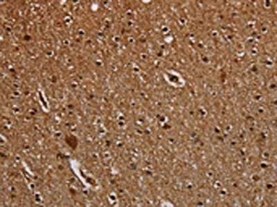 DCAF6 Antibody
