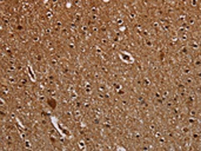 DCAF6 antibody