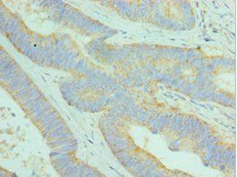 DCAF7 Antibody