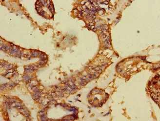 DCAF8 Antibody