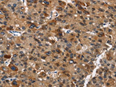DCC Antibody