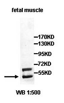 DCDC2 antibody