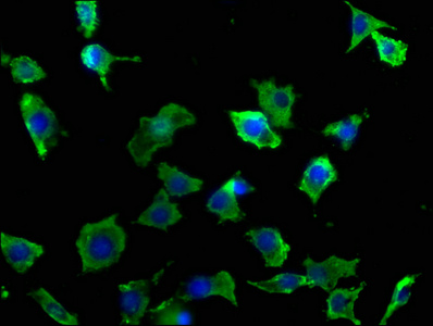 DCHS1 Antibody