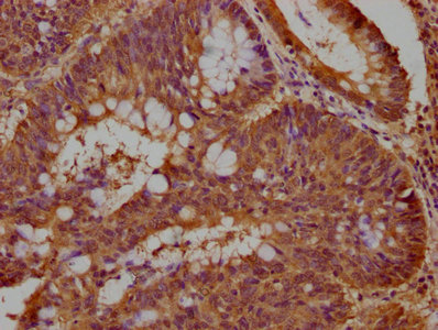 DCHS1 Antibody