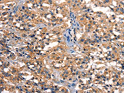 DCLK1 Antibody