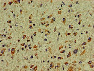 DCLK1 Antibody