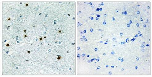 DCLK3 Antibody