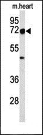 DCLRE1C antibody