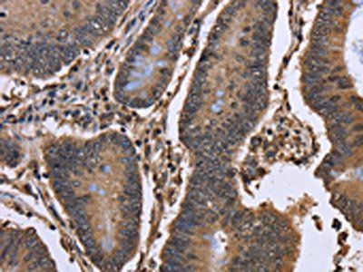 DCP1A Antibody
