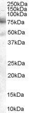 Goat anti-DCP1A Antibody