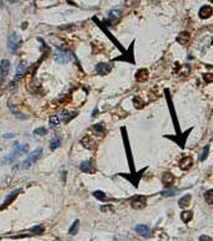 Dcp1a Rabbit Polyclonal Antibody