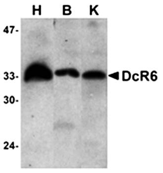 DcR3 Antibody
