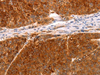 DCT Antibody