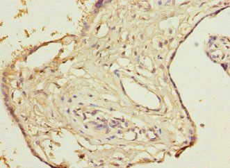 DCTD Antibody