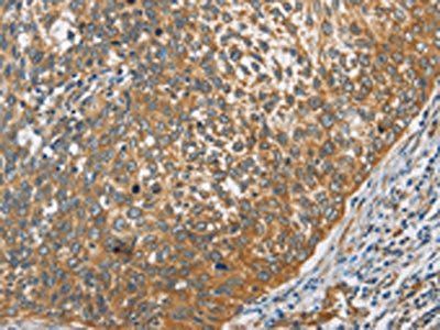 DCTN2 Antibody