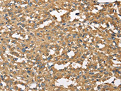DCTN2 Antibody