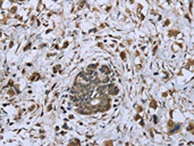 DCTN4 Antibody