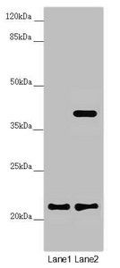 DCTN6 antibody