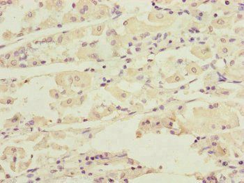 DCTN6 Antibody