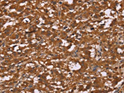 DCTN6 Antibody