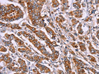 DCTN6 Antibody