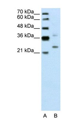 DCUN1D1 antibody