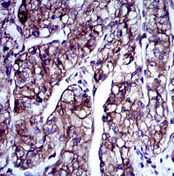 DCX Antibody