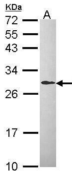 DCXR antibody
