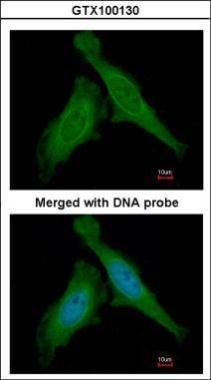 damage specific DNA binding protein 1 Antibody