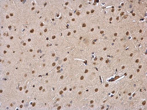 DDB1 Rabbit Polyclonal Antibody