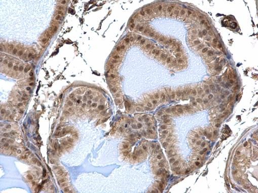 DDB1 Rabbit Polyclonal Antibody