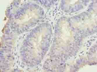 DDI2 antibody